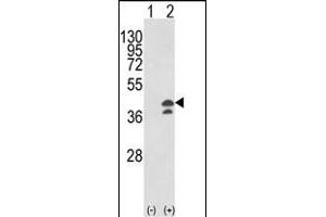 Western blot analysis of GOT1 (arrow) using rabbit polyclonal GOT1 Antibody (N-term) (ABIN650769 and ABIN2839550). (GOT1 Antikörper  (N-Term))