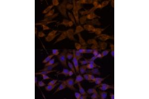 Immunofluorescence analysis of HeLa cells using UGT2B7 Polyclonal Antibody (ABIN6132908, ABIN6149903, ABIN6149904 and ABIN6218790) at dilution of 1:100 (40x lens).