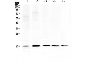 Western blot analysis of Psoriasin using anti-Psoriasin antibody . (S100A7 Antikörper  (AA 2-101))