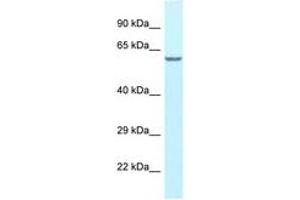 Image no. 1 for anti-Hyaluronan Binding Protein 2 (HABP2) (AA 338-387) antibody (ABIN6747676) (HABP2 Antikörper  (AA 338-387))