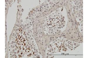 Immunoperoxidase of monoclonal antibody to TNP1 on formalin-fixed paraffin-embedded human testis. (TNP1 Antikörper  (AA 1-55))
