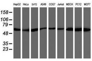 Image no. 7 for anti-V-Akt Murine Thymoma Viral Oncogene Homolog 1 (AKT1) antibody (ABIN1496556) (AKT1 Antikörper)