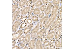 Immunohistochemistry of paraffin-embedded mouse kidney using SLC14 Rabbit pAb (5991) at dilution of 1:200 (40x lens).