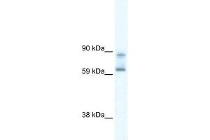 DDX42 antibody used at 5 ug/ml to detect target protein. (DDX42 Antikörper)