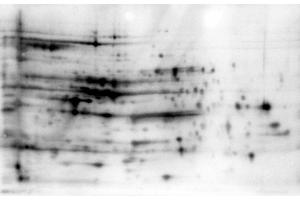 2D Western Blot of E. (Chemiluminescent Western Blot Kit for detection of E.coli Host Cell Proteins (HCP))