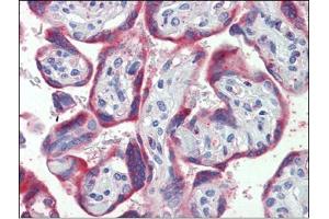 Placenta, Human: Formalin-Fixed, Paraffin-Embedded (FFPE) (PDGFB Antikörper  (C-Term))