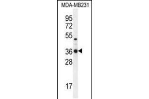 Western blot analysis in MDA-MB231 cell line lysates (35ug/lane). (TPSD1 Antikörper  (C-Term))