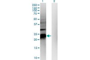 Western Blot analysis of HDHD1A expression in transfected 293T cell line by HDHD1A monoclonal antibody (M05), clone 4F12. (HDHD1 Antikörper  (AA 107-212))