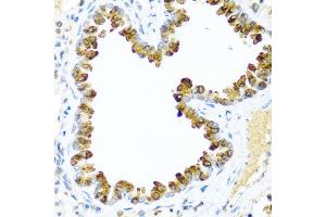 Immunohistochemistry of paraffin-embedded mouse lung using NRG4 antibody at dilution of 1:100 (40x lens). (Neuregulin 4 Antikörper)
