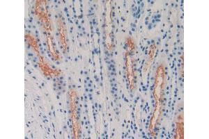 Used in DAB staining on fromalin fixed paraffin- embedded Kidney tissue (LPHN2 Antikörper  (AA 139-398))