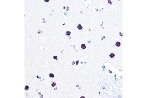 Immunohistochemistry of paraffin-embedded human brain using hnRNP C Rabbit pAb (ABIN7267630) at dilution of 1:100 (40x lens). (HNRNPC Antikörper)