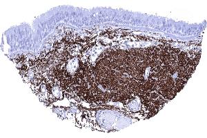 Bronchus mucosa High content of elastin fibres along the bronchus mucosa (Rekombinanter Elastin Antikörper)