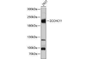 Western blot analysis of extracts of 293T cells, using ZCCHC11 Antibody (ABIN6128939, ABIN6150406, ABIN6150407 and ABIN6221650) at 1:3000 dilution. (ZCCHC11 Antikörper  (AA 1-290))