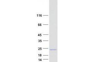 Western Blotting (WB) image for Calcium Regulated Heat Stable Protein 1, 24kDa (CARHSP1) (Transcript Variant 2) protein (Myc-DYKDDDDK Tag) (ABIN2713181)
