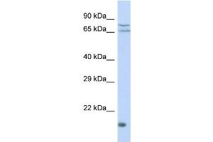 Host: Rabbit Target Name: ZNF195 Sample Type: HepG2 Whole cell lysates Antibody Dilution: 1.