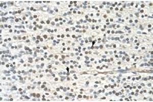 Immunohistochemical staining (Formalin-fixed paraffin-embedded sections) of human brain with GAPVD1 polyclonal antibody  at 4-8 ug/mL working concentration.