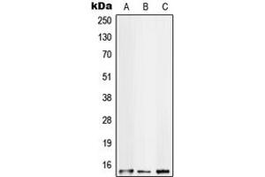Western blot analysis of S100-A10 expression in HT29 (A), HeLa (B), A431 (C) whole cell lysates. (S100A10 Antikörper  (Center))