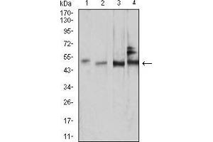Western Blotting (WB) image for anti-SMAD, Mothers Against DPP Homolog 1 (SMAD1) (AA 1-110) antibody (ABIN5877225)