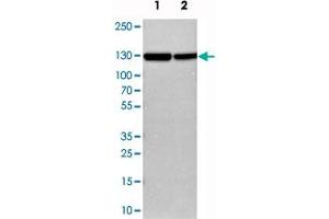 Western blot analysis of cell lysates with CFB polyclonal antibody . (Complement Factor B Antikörper)