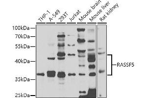 Western blot analysis of extracts of various cell lines, using R antibody  at 1:1000 dilution.