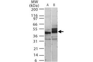 Western blot analysis of human SIGIRR in 15 ugs of (A) human kidney and (B) mouse kidney cell lysate. (SIGIRR Antikörper  (AA 334-358))