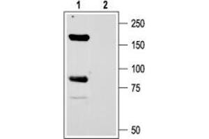 Expression of ASIC1 in rat brain - Immunohistochemical staining of rat globus pallidus using Anti-ASIC1 Antibody (ABIN7042915, ABIN7045236 and ABIN7045237). (ASIC1 Antikörper  (C-Term, Intracellular))