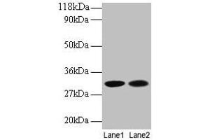 Western blot All lanes: MRPL9 antibody at 2 μg/mL Lane 1: EC109 whole cell lysate Lane 2: 293T whole cell lysate Secondary Goat polyclonal to rabbit IgG at 1/15000 dilution Predicted band size: 31 kDa Observed band size: 31 kDa (MRPL9 Antikörper  (AA 60-267))