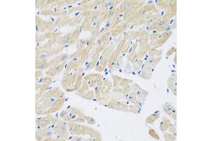Immunohistochemistry of paraffin-embedded mouse heart using TGM5 antibody at dilution of 1:200 (40x lens). (Transglutaminase 5 Antikörper)