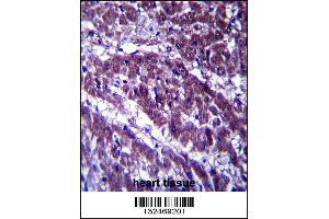 OGDH Antibody immunohistochemistry analysis in formalin fixed and paraffin embedded human heart tissue followed by peroxidase conjugation of the secondary antibody and DAB staining. (alpha KGDHC Antikörper  (C-Term))