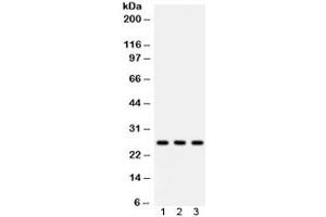 Western blot testing of 1) rat lung, 2) mouse lung, 3) A549 lysate with SFTPA1/2 antibody. (SFTPA1/ 2 Antikörper)