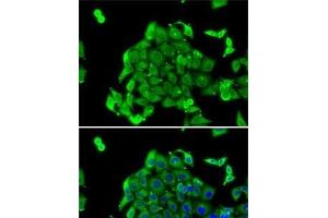 Immunofluorescence analysis of MCF7 cells using RPS14 Polyclonal Antibody (RPS14 Antikörper)