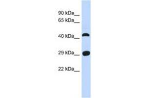 Image no. 1 for anti-Chromosome 4 Open Reading Frame 22 (C4orf22) (AA 35-84) antibody (ABIN6741345) (C4orf22 Antikörper  (AA 35-84))