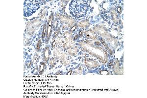 Rabbit Anti-MUC1 Antibody  Paraffin Embedded Tissue: Human Kidney Cellular Data: Epithelial cells of renal tubule Antibody Concentration: 4.
