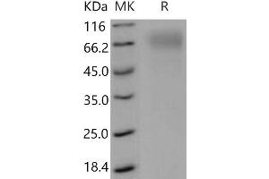 Western Blotting (WB) image for Scavenger Receptor Class B, Member 1 (SCARB1) protein (His tag) (ABIN7320319)