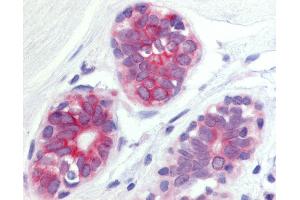 Immunohistochemistry (IHC) image for anti-Wingless-Type MMTV Integration Site Family, Member 6 (WNT6) (Internal Region) antibody (ABIN1049481)