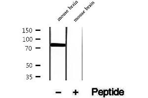 Western blot analysis of extracts of mouse brain tissue, using Phospho-Tau (Ser202) Antibody.