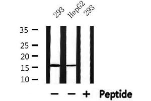 Western blot analysis of extracts from HepG2 and 293, using RPS19 Antibody. (RPS19 Antikörper  (Internal Region))