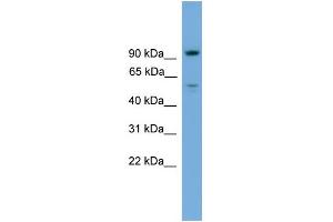 WB Suggested Anti-C16orf71 Antibody Titration: 0. (C16ORF71 Antikörper  (Middle Region))