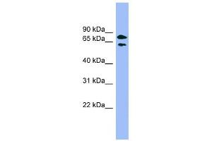 PANK4 antibody used at 1 ug/ml to detect target protein. (PANK4 Antikörper  (Middle Region))