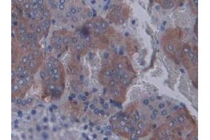 Detection of STAT2 in Rat Adrenal gland Tissue using Polyclonal Antibody to Signal Transducer And Activator Of Transcription 2 (STAT2) (STAT2 Antikörper  (AA 587-838))