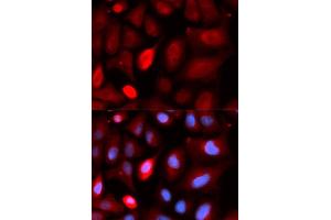 Immunofluorescence analysis of U20S cell using PDLIM5 antibody. (PDLIM5 Antikörper)