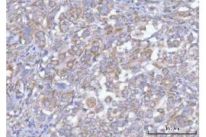 IHC analysis of Hamartin/TSC1 using anti-Hamartin/TSC1 antibody (ABIN7599499). (TSC1 Antikörper  (AA 1-618))