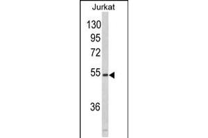 Western blot analysis of MFAP1 in Jurkat cell line lysates (35ug/lane) (MFAP1 Antikörper  (N-Term))