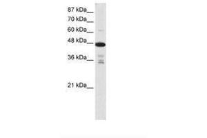 Image no. 2 for anti-Protein Arginine Methyltransferase 2 (PRMT2) (N-Term) antibody (ABIN203135) (PRMT2 Antikörper  (N-Term))