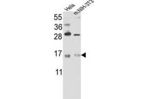 Western Blotting (WB) image for anti-RNA Binding Motif Protein 3 (RBM3) antibody (ABIN3003187) (RBM3 Antikörper)
