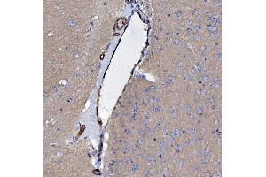 IHC analysis of EHD3 using anti-EHD3 antibody (ABIN7602777). (EHD3 Antikörper  (C-Term))