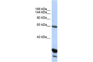 Host:  Rabbit  Target Name:  UNC5C  Sample Type:  HepG2 Whole Cell lysates  Antibody Dilution:  1. (Unc5c Antikörper  (C-Term))