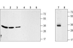 Western blot analysis of rat kidney (lanes 1 and 4), rat brain (lanes 2 and 5), mouse brain (lanes 3 and 6) membranes and CCF-SSTGI (lanes 7 and 8) cell line lysate: - 1-3,7.
