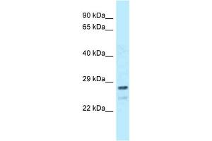 WB Suggested Anti-FKBP14 Antibody Titration: 1. (FKBP14 Antikörper  (Middle Region))