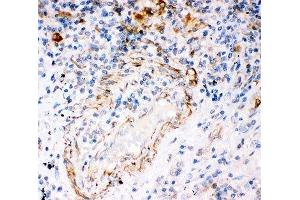 Immunohistochemistry (IHC) image for anti-Inositol 1,4,5-Trisphosphate Receptor, Type 3 (ITPR3) (AA 2411-2758) antibody (ABIN3031328)
